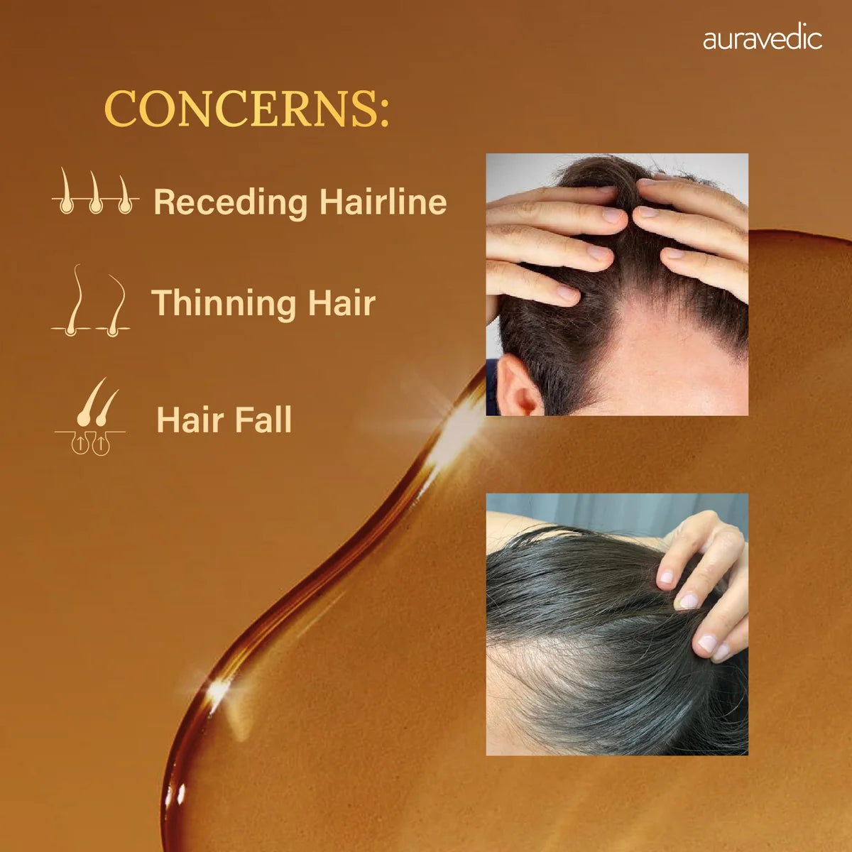 Auravedic Rosemary Hair Oil (100ml)
